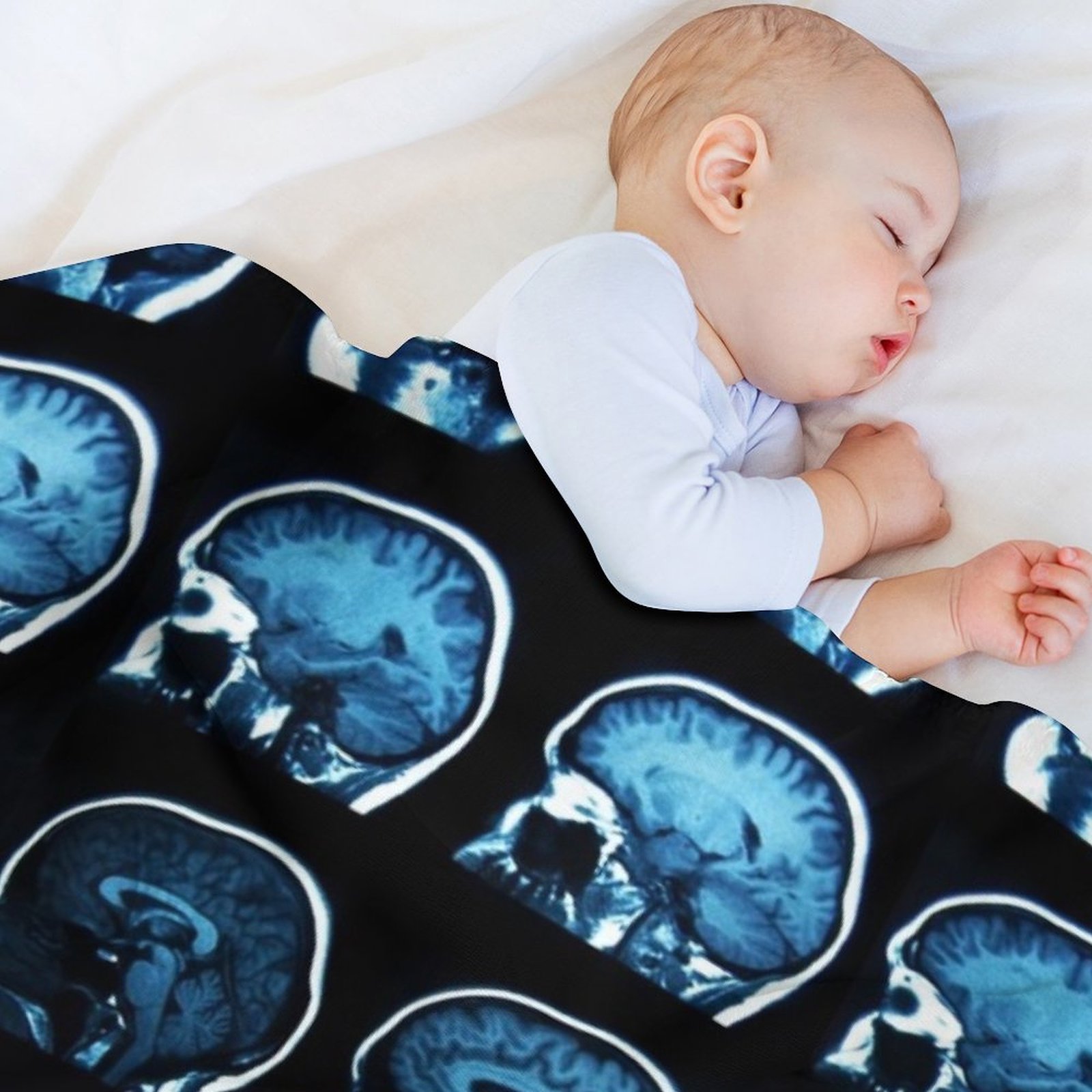 Brain MRI x-ray Throw Blanket  - مراجعة 3D Printing X Ray وسعره